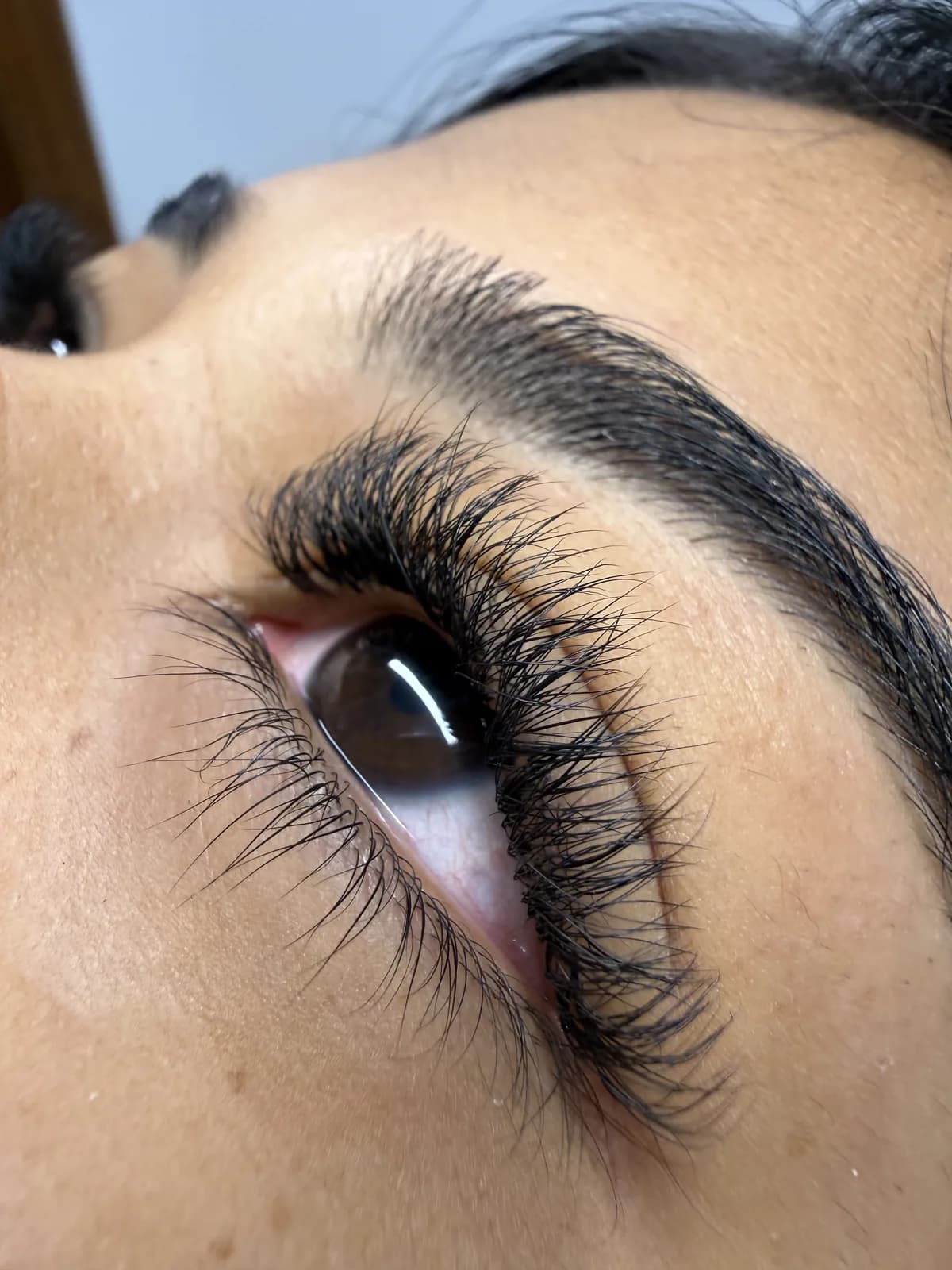 Depilação a laser — sessão no studio